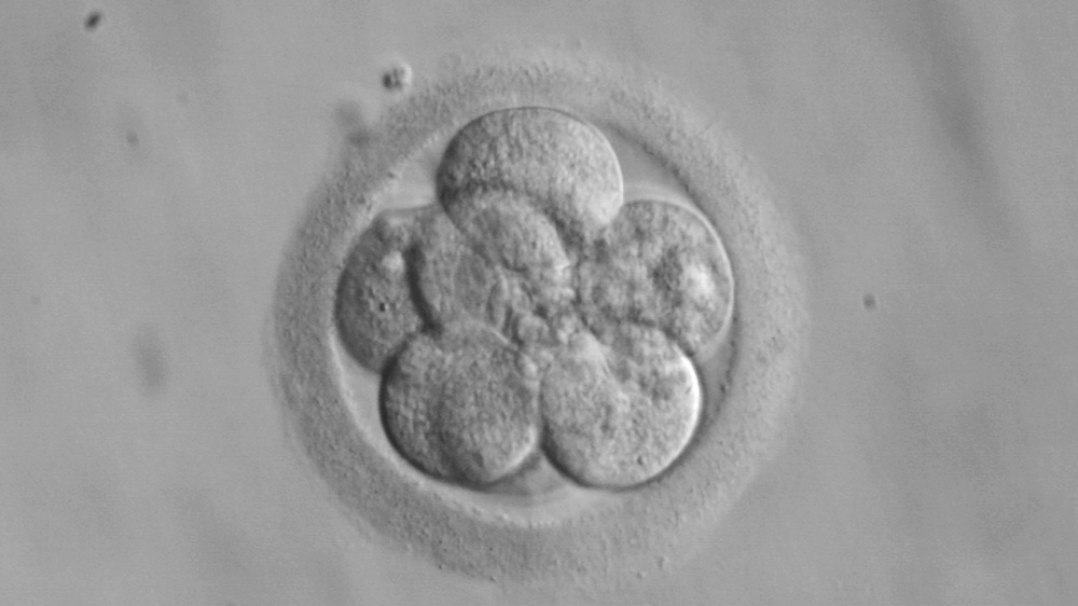 8 cell embryo